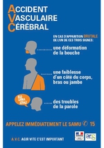 "AVC, agir vite, c'est important" - Affiche - Ministère de la santé