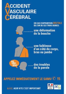 "AVC, agir vite, c'est important" - Affiche - Ministère de la santé