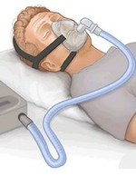 Apnée du sommeil - actualité Cespharm